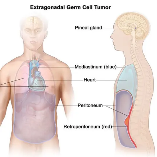 Alpha-Fetoprotein (AFP) Tumor Marker